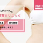 湘南美容クリニックの脱毛効果は？脱毛実感できる回数は？