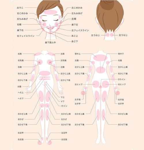 ストラッシュの脱毛範囲