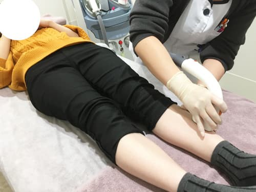 医療脱毛の体験