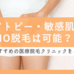 VIO脱毛がしたいけどアトピー・敏感肌でもできる？