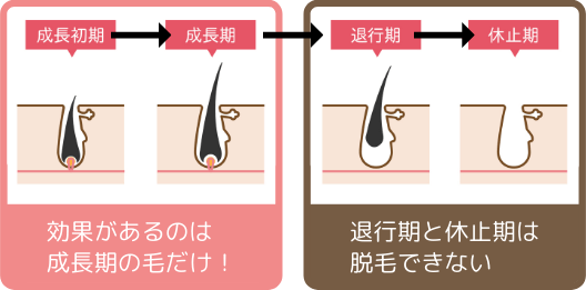 脱毛器「ケノン」の効果的な使用頻度┃脱毛間隔は２週間？１週間に１回？