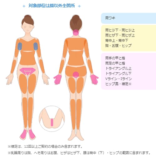 ミュゼ脱毛範囲