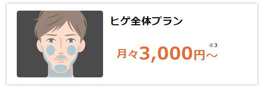 ヒゲ脱毛（ヒゲ全体）の料金と脱毛範囲