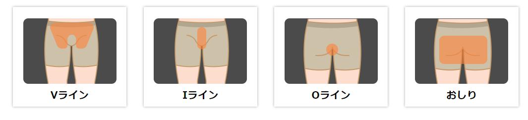 陰部脱毛（1ヵ所）の料金と脱毛範囲