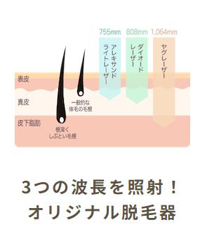 スキミークリニックの脱毛器